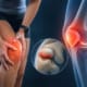 syndrome fémoro-patellaire